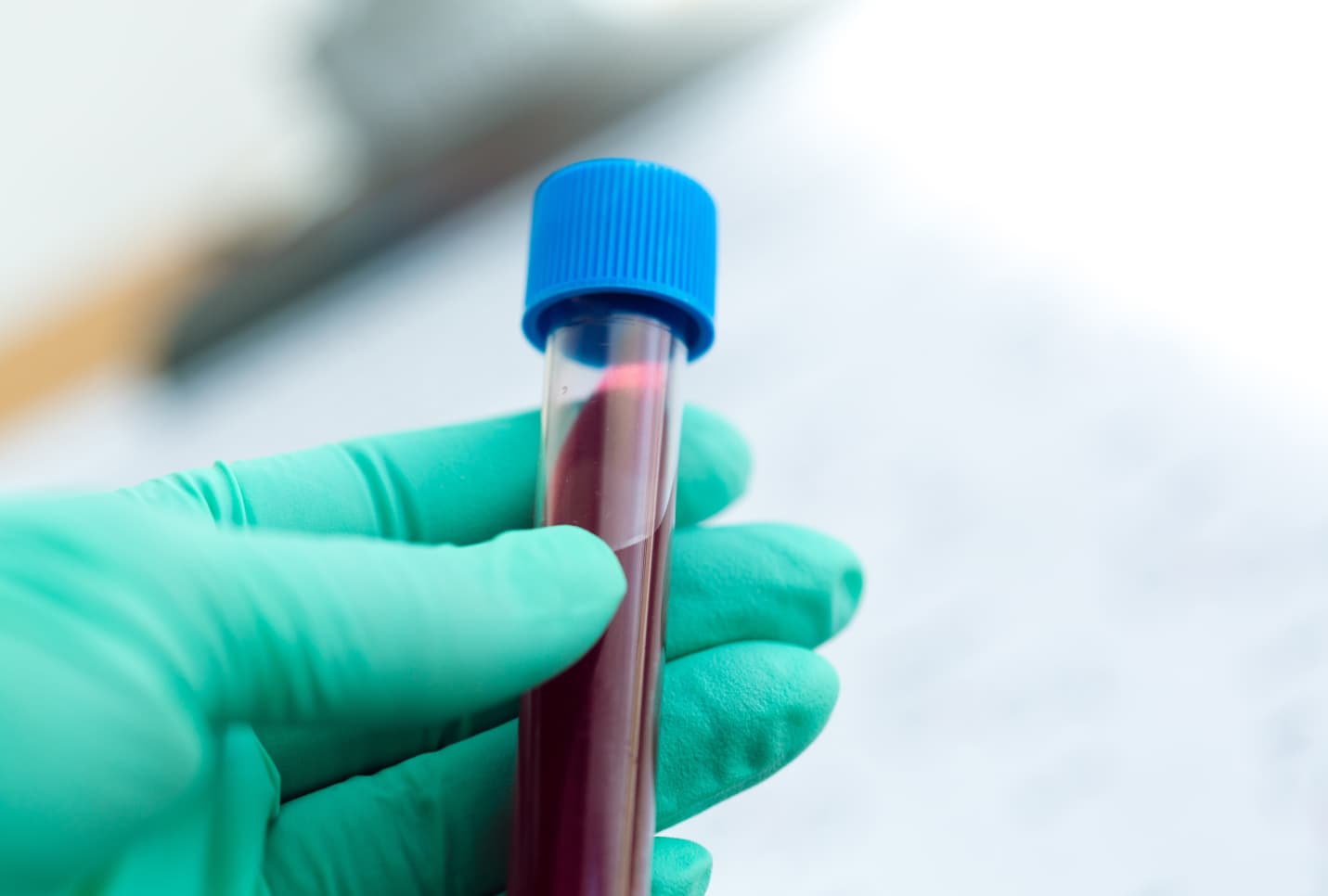 Cover image for Is Alcohol a Blood Thinner? Everything To Know